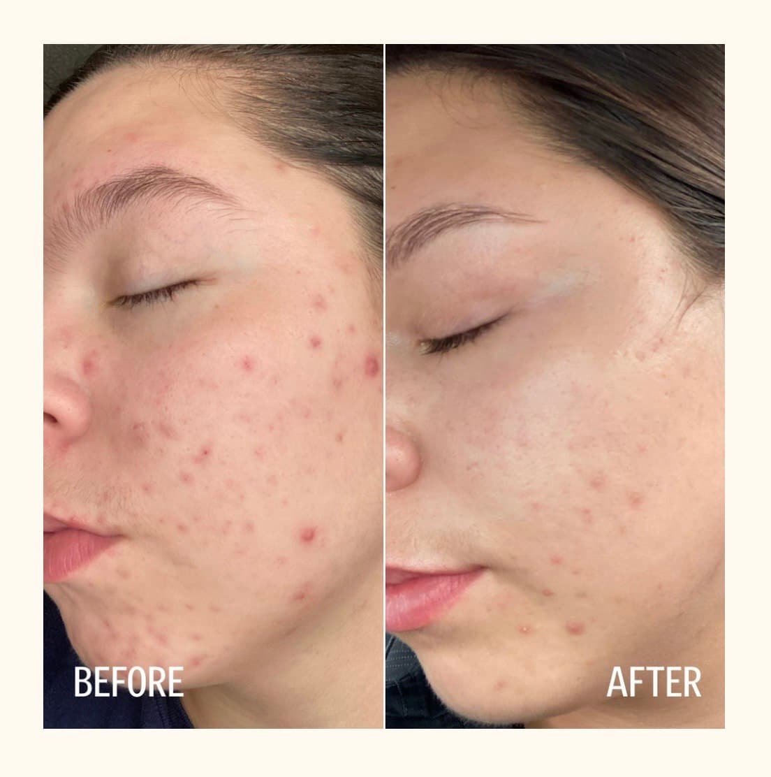 Client before and after