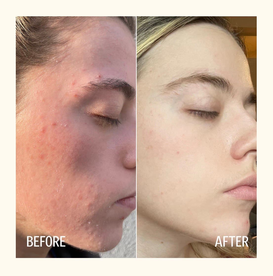 Client before and after