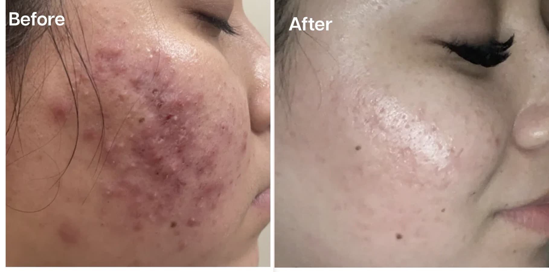 Client before and after